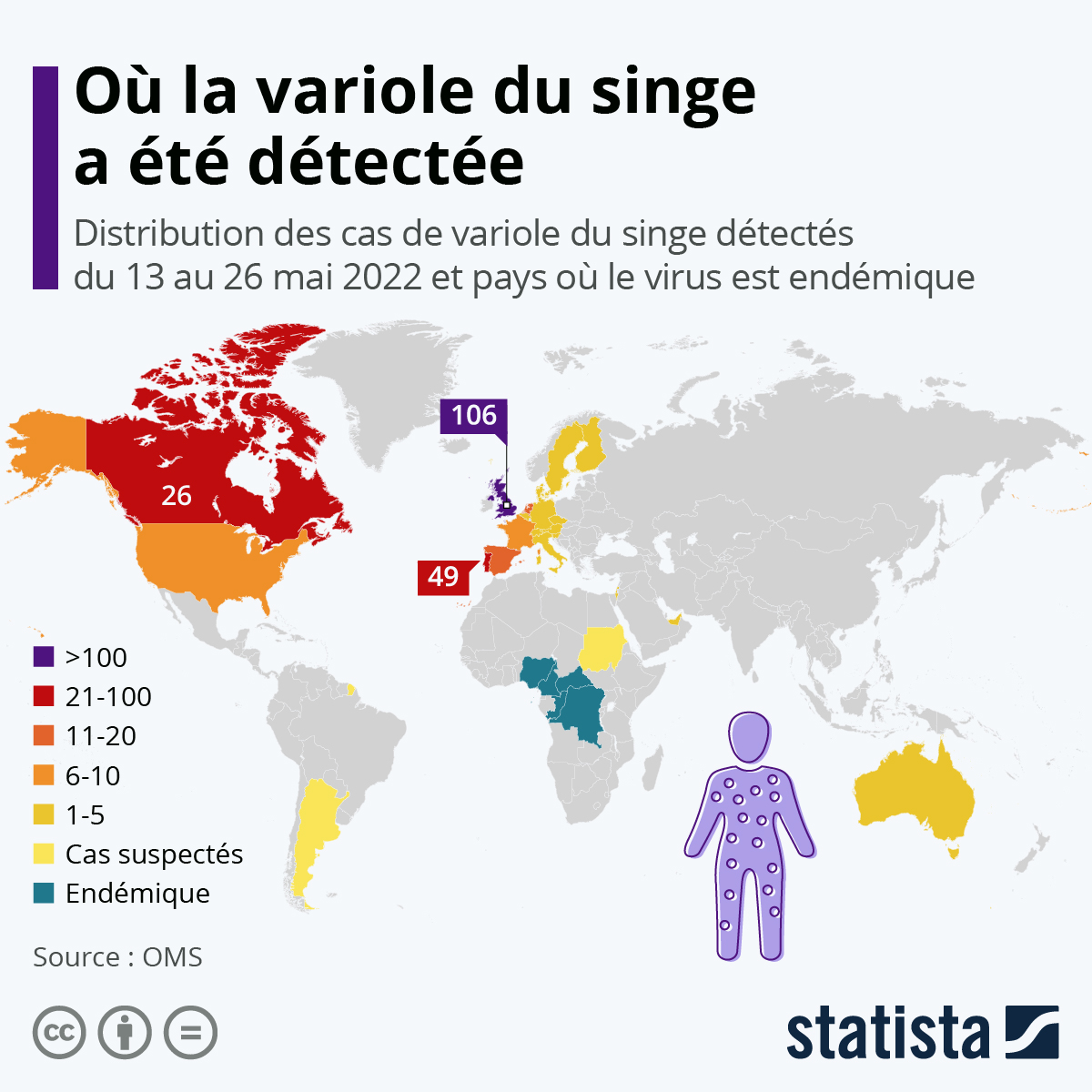 variole du singe infographie